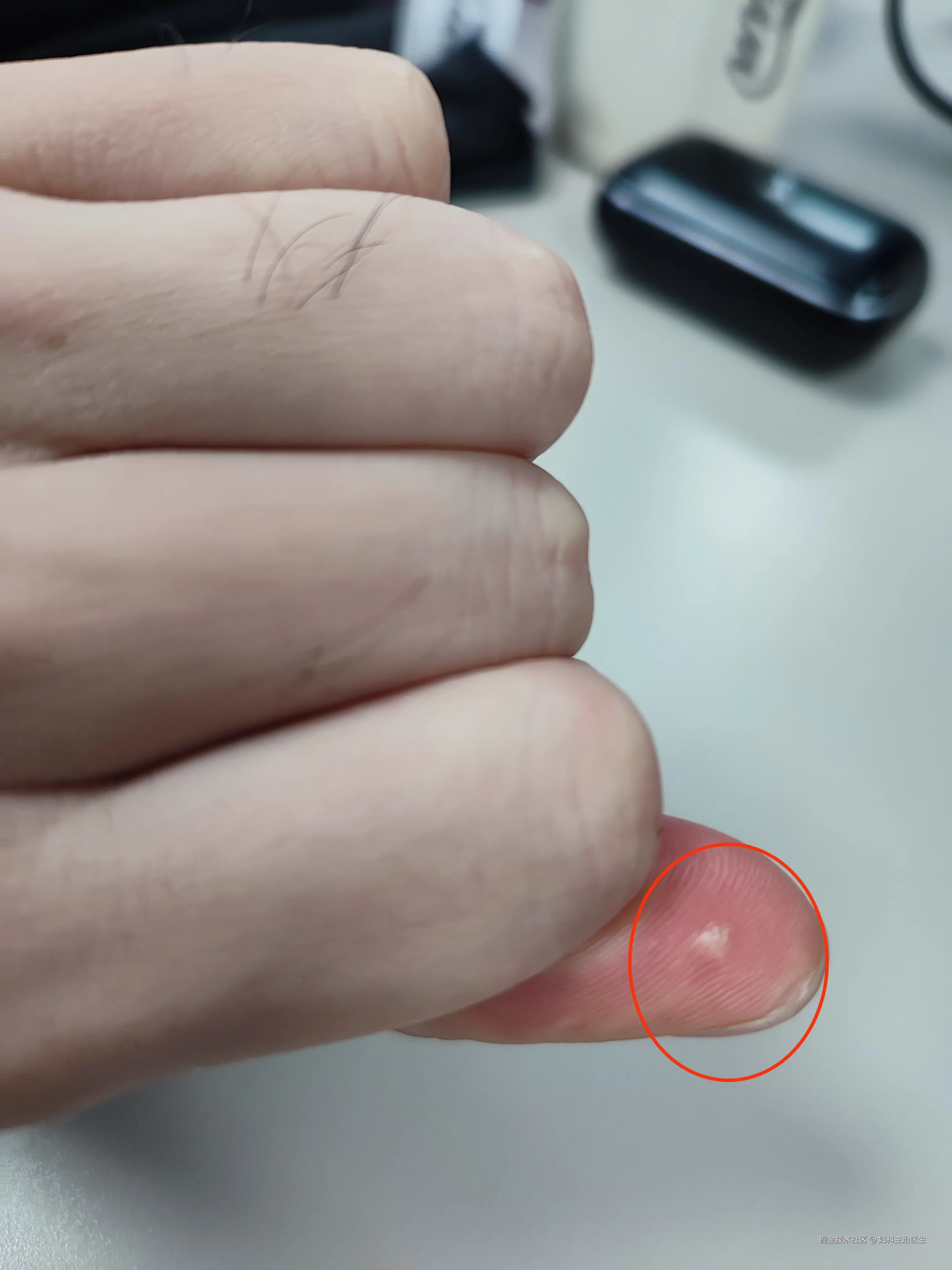 妇科主治医生于2025-07-01 16:21发布的图片