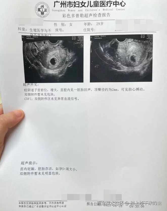 树上掉下来的虫于2025-04-28 02:14发布的图片