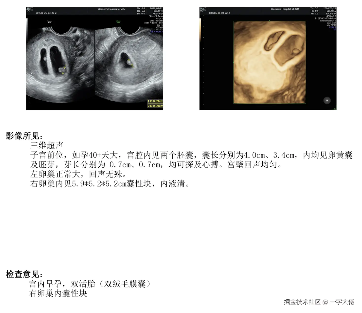 一字大佬于2026-03-24 10:02发布的图片
