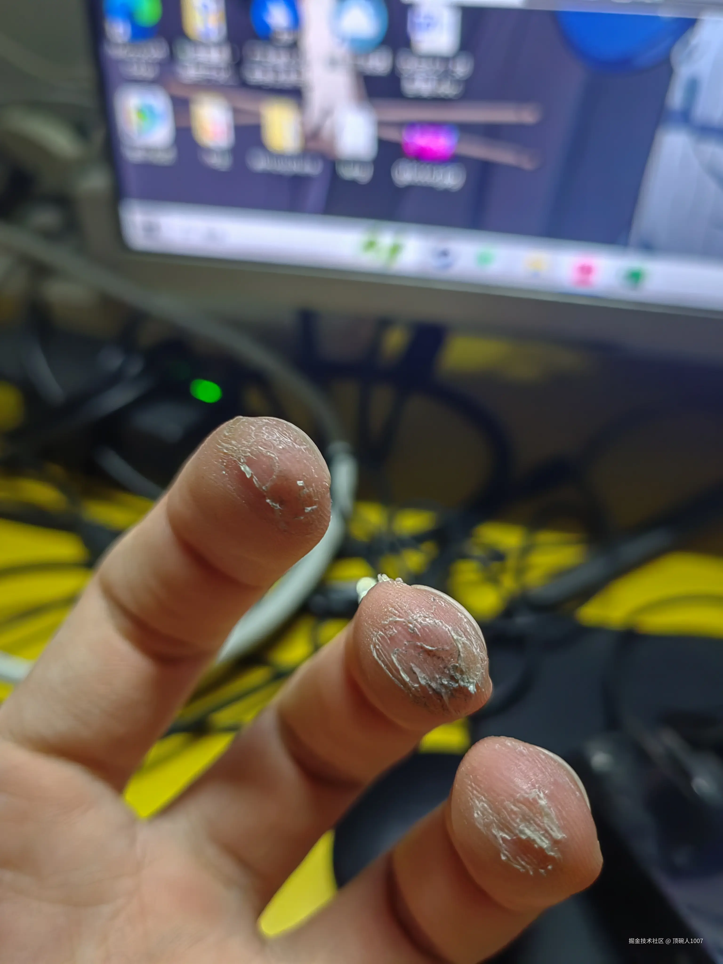 顶碗人1007于2025-04-22 10:17发布的图片