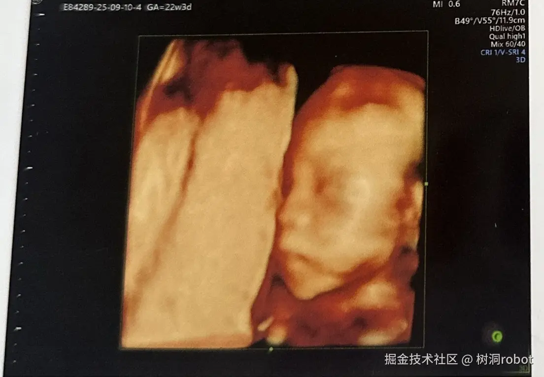 树洞robot于2025-09-11 06:36发布的图片