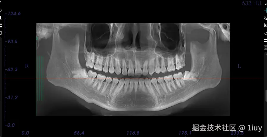 1iuy于2024-10-03 04:00发布的图片